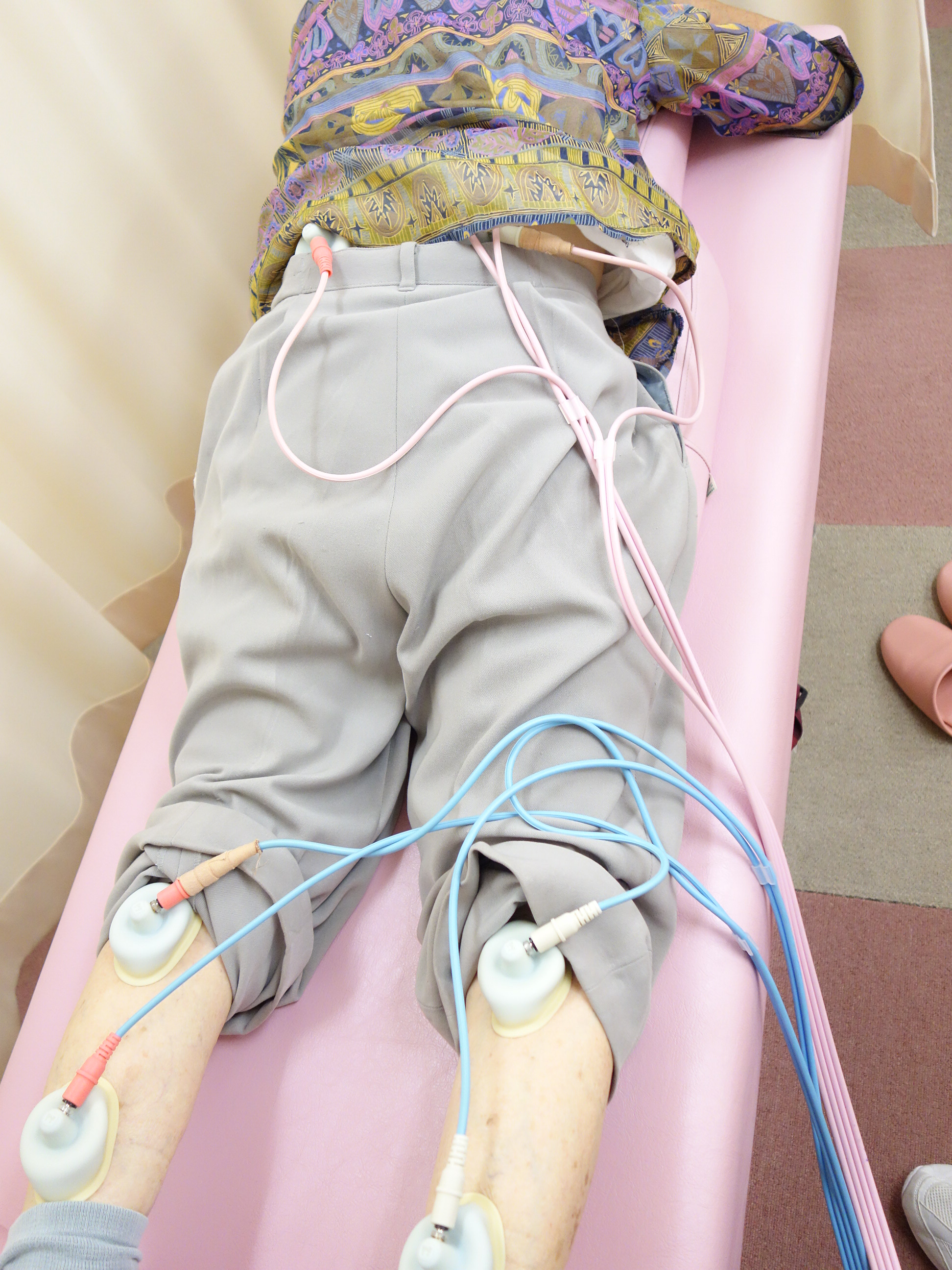 腰椎すべり症の電気治療の写真