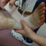 横浜市西区の整骨院「宮谷小交差点前せいこついん」の足首の捻挫のテーピング治療イメージ