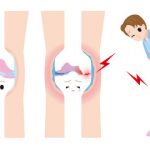 遠絡（えんらく）治療の整骨院の変形性膝関節症のページへ
