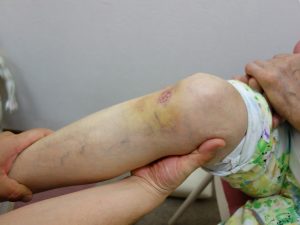 膝の痛み治療の整骨院「宮谷小交差点前せいこついん」の膝の痛みを治療するイメージ1